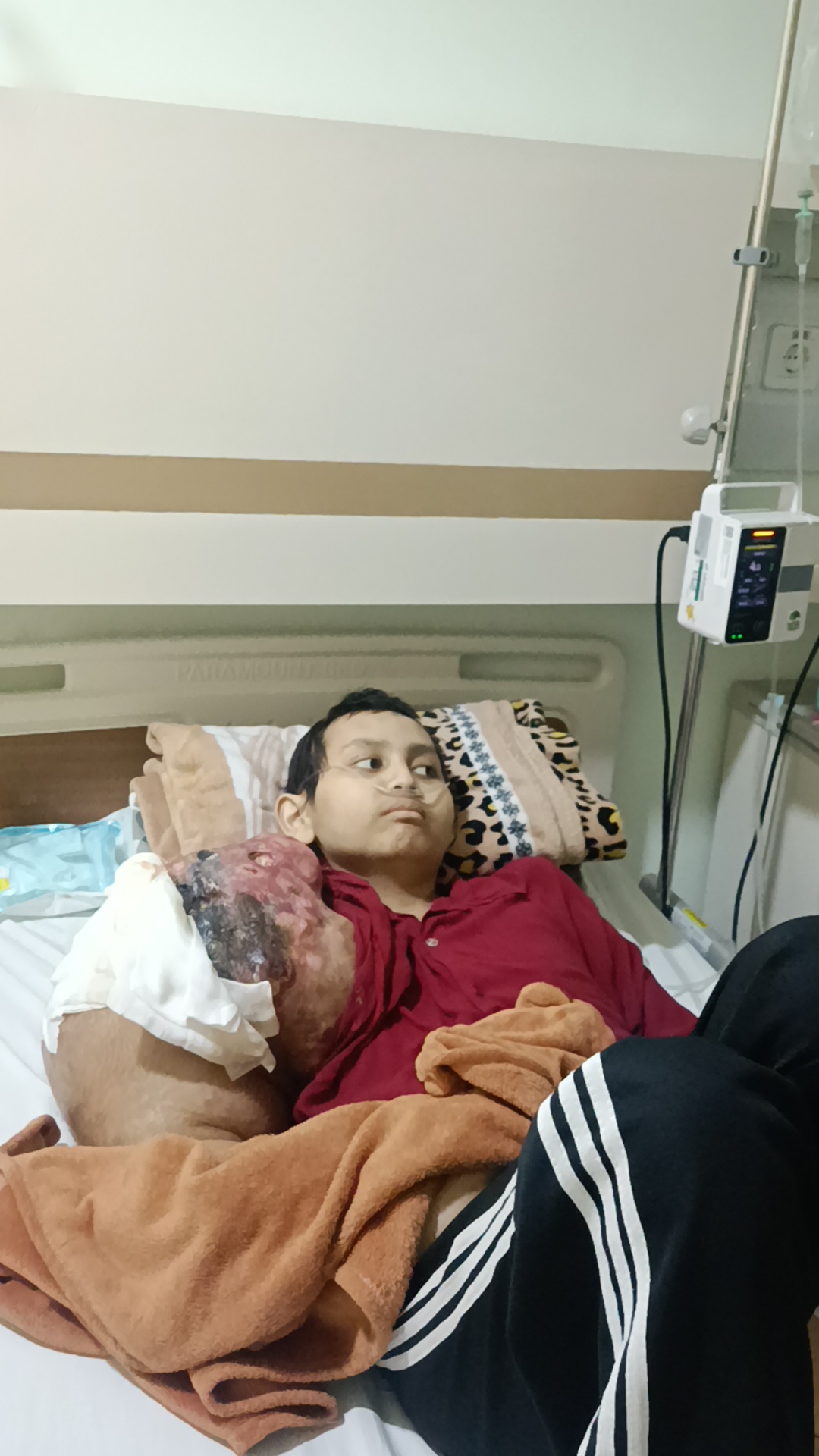 HELP! Tangan Bengkak membusuk krn Tumor Stadium Akhir, nyawa Reza kritis!