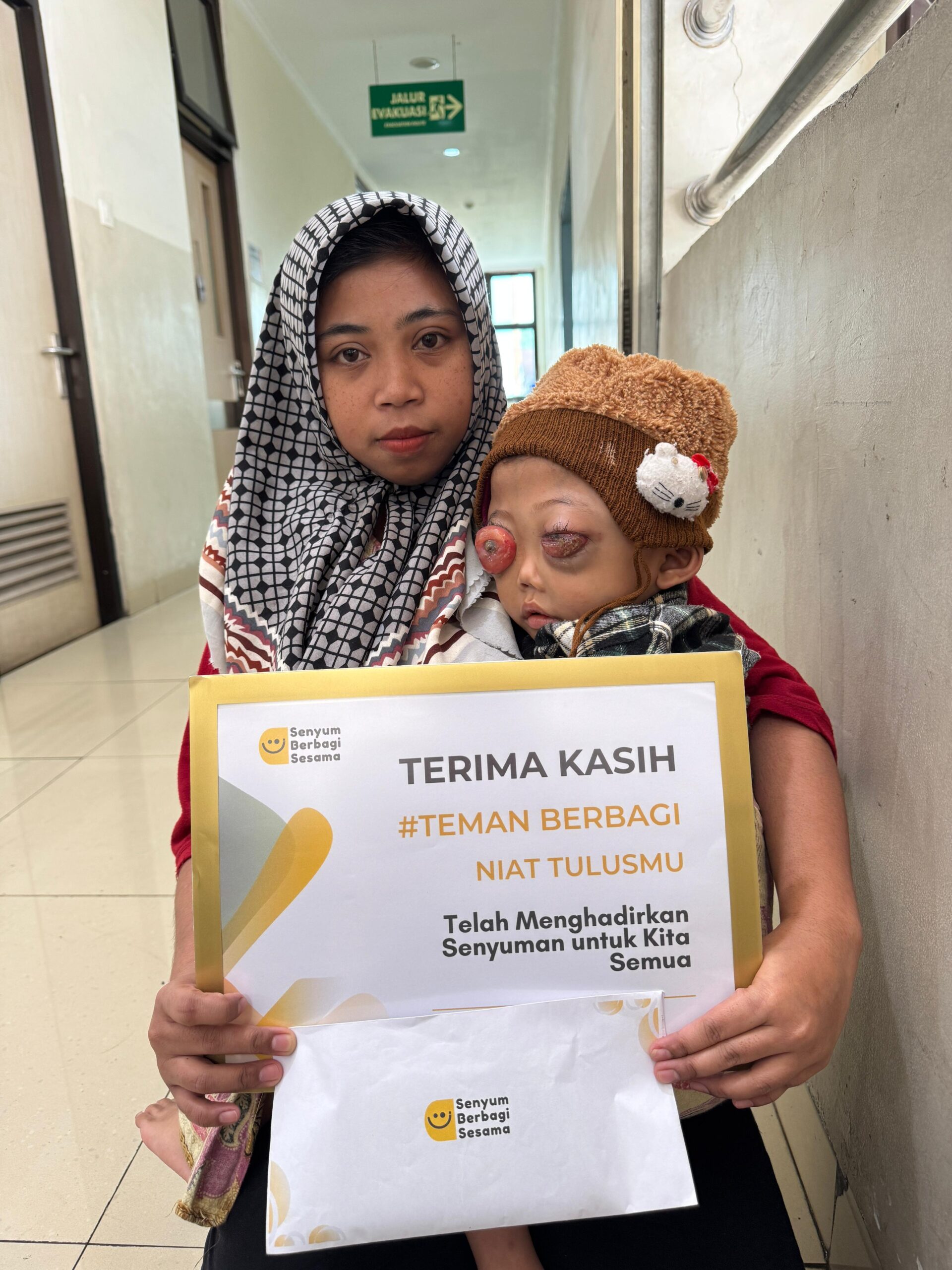 Darah Mengalir Dari Mata! Selamatkan Ahmad Dari Kanker Ganas