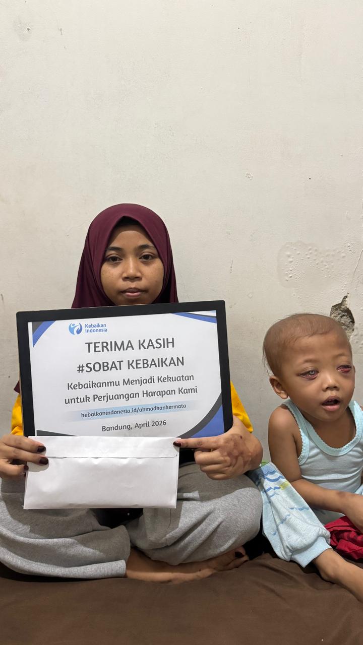 Darah Mengalir Dari Mata! Selamatkan Ahmad Dari Kanker Ganas