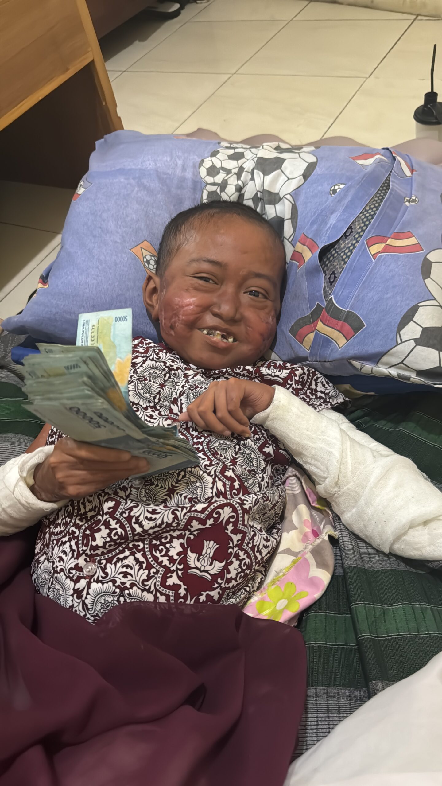 HELP! Ibu Tunggal Berjuang Demi Anak Sakit Kronis Langka! Bantu Arfan Sembuh