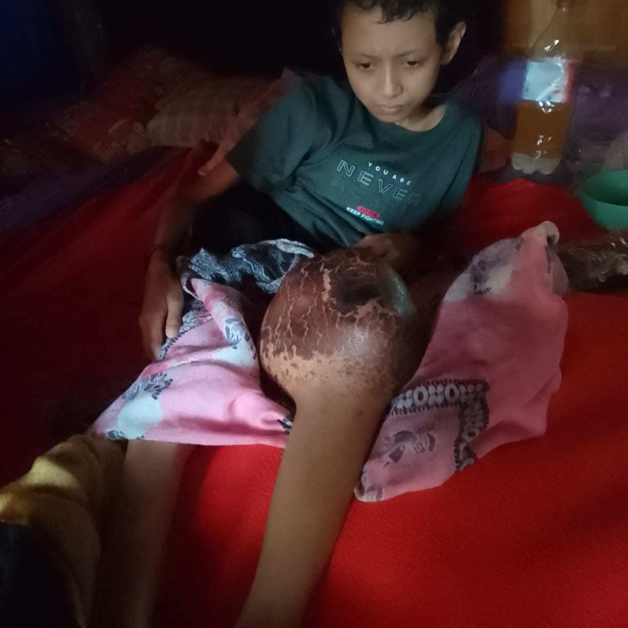 OPERASI TERTUNDA hingga putus sekolah, Ilyas Butuh Pertolongan Segera!